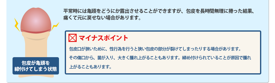 包皮が亀頭を締付けてしまう状態