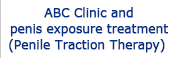 ABC Clinic and penis exposure treatment (Penile Traction Therapy)