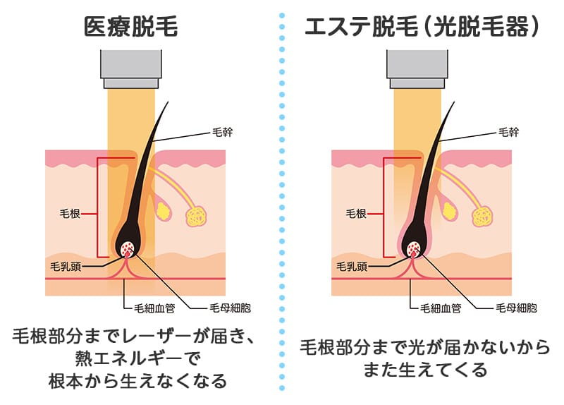 オメプラゾールは勃起不全に影響を及ぼしますか？