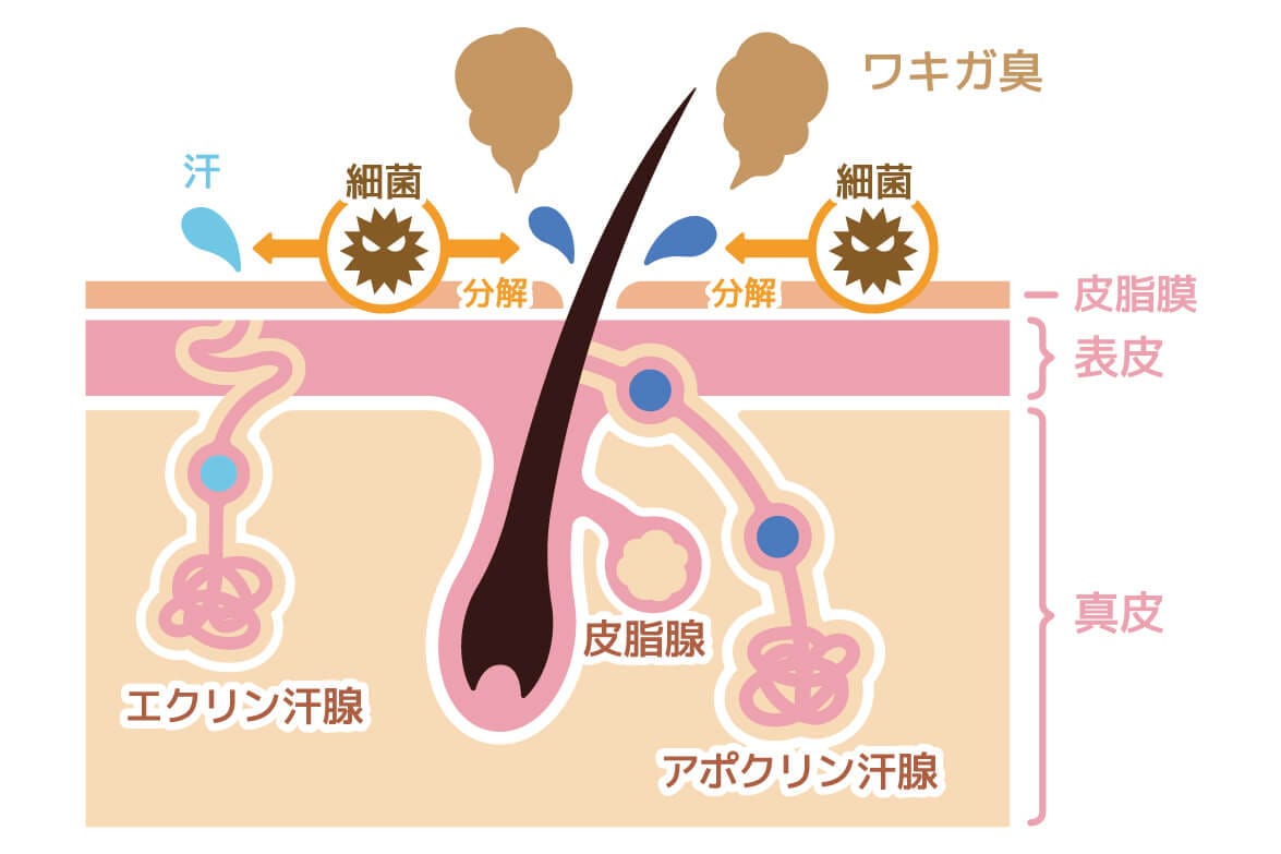 ワキガの概略イメージ