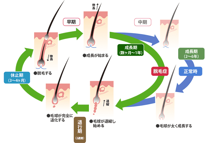 乱れtヘアサイクル